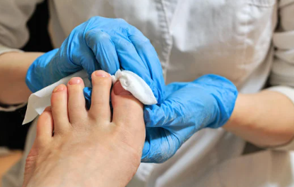Nail Reconstruction